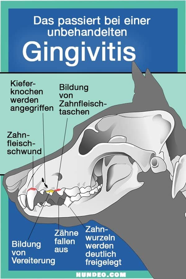 Abbildung, die die Stadien einer unbehandelten Zahnfleischentzündung im Kiefer eines Hundes zeigt. Sie enthält Bezeichnungen für Kieferknochenabbau, Zahnfleischrückgang, Taschenbildung, Abszessbildung, Zahnverlust und freiliegende Zahnwurzeln.